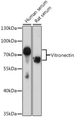 ABclonal Technology&nbsp;Vitronectin Rabbit pAb