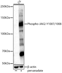 ABclonal Technology&nbsp;Phospho-JAK2-Y1007/1008 Rabbit pAb