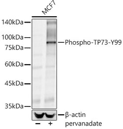 ABclonal Technology&nbsp;Phospho-TP73-Y99 Rabbit pAb