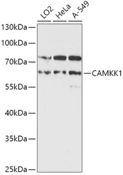 ABclonal Technology&nbsp;CAMKK1 Rabbit pAb
