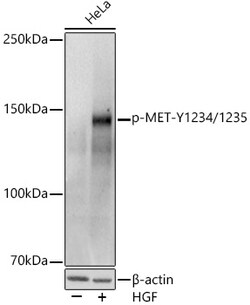 ABclonal Technology&nbsp;Phospho-MET-Y1234/1235 Rabbit pAb