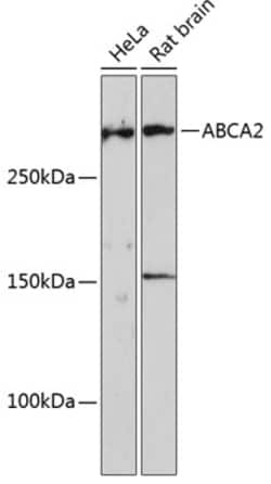 ABclonal Technology&nbsp;ABCA2 Rabbit pAb
