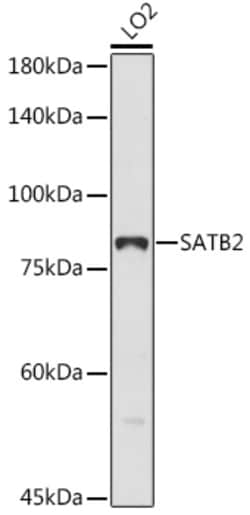 ABclonal Technology&nbsp;SATB2 Rabbit pAb