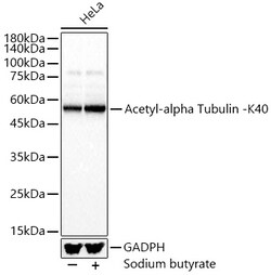 ABclonal Technology&nbsp;Acetyl-alpha Tubulin -K40 Rabbit pAb