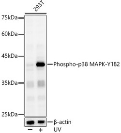 ABclonal Technology&nbsp;Phospho-p38 MAPK-Y182 Rabbit pAb