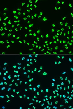 ABclonal Technology&nbsp;Phospho-BRCA1-S988 Rabbit pAb