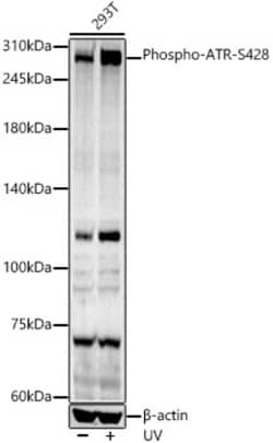 ABclonal Technology&nbsp;Phospho-ATR-S428 Rabbit pAb