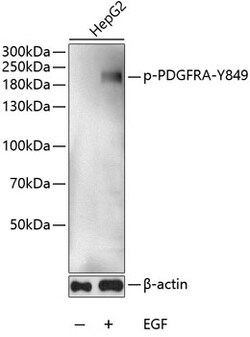ABclonal Technology&nbsp;Phospho-PDGFR alpha-Y849 Rabbit pAb