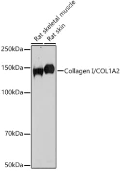 ABclonal Technology&nbsp;Collagen I/COL1A2 Rabbit pAb