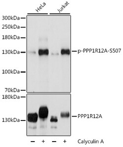 ABclonal Technology&nbsp;Phospho-PPP1R12A-S507 Rabbit pAb