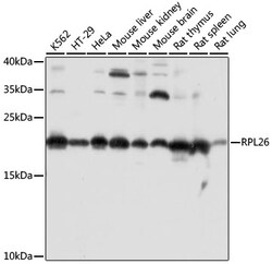 ABclonal Technology&nbsp;RPL26 Rabbit pAb