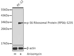 ABclonal Technology&nbsp;Phospho-S6 Ribosomal Protein (RPS6)-S235 Rabbit pAb