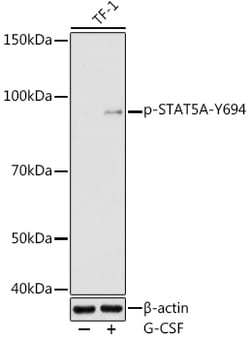 ABclonal Technology&nbsp;Phospho-STAT5A-Y694 Rabbit pAb