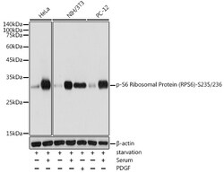 ABclonal Technology&nbsp;Phospho-S6 Ribosomal Protein (RPS6)-S235/236 Rabbit pAb