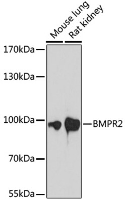 ABclonal Technology&nbsp;BMPR2 Rabbit pAb
