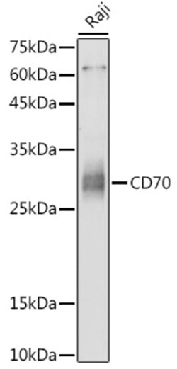 ABclonal Technology&nbsp;CD70 Rabbit pAb