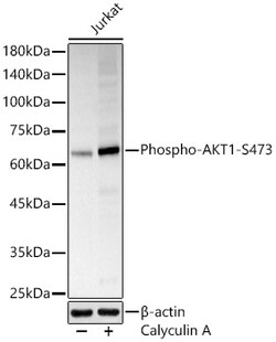 ABclonal Technology&nbsp;Phospho-AKT1-S473 Rabbit pAb