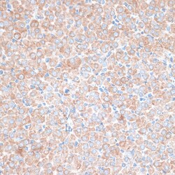 ABclonal Technology&nbsp;PMEPA1 Rabbit pAb