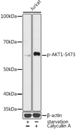 ABclonal Technology&nbsp;Phospho-AKT1-S473 Rabbit pAb