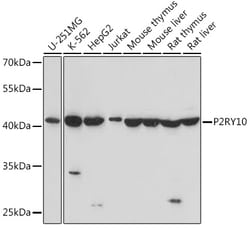 ABclonal Technology&nbsp;P2RY10 Rabbit pAb