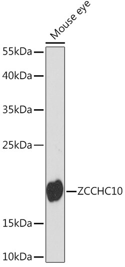 ABclonal Technology&nbsp;ZCCHC10 Rabbit pAb
