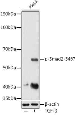 ABclonal Technology&nbsp;Phospho-Smad2-S467 Rabbit pAb