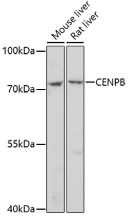 ABclonal Technology&nbsp;CENPB Rabbit pAb