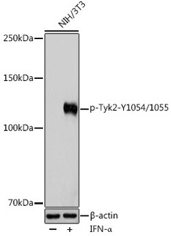 ABclonal Technology&nbsp;Phospho-Tyk2-Y1054/1055 Rabbit pAb