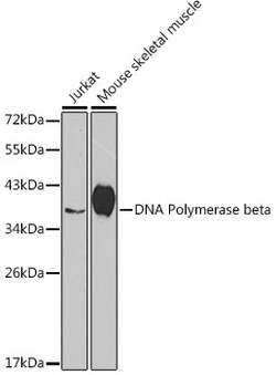 ABclonal Technology&nbsp;[KO Validated] DNA Polymerase beta Rabbit pAb