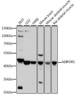 ABclonal Technology&nbsp;ADIPOR1 Rabbit pAb