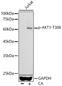 ABclonal Technology&nbsp;Phospho-AKT1-T308 Rabbit pAb