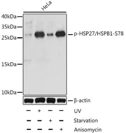 ABclonal Technology&nbsp;Phospho-HSP27/HSPB1-S78 Rabbit pAb