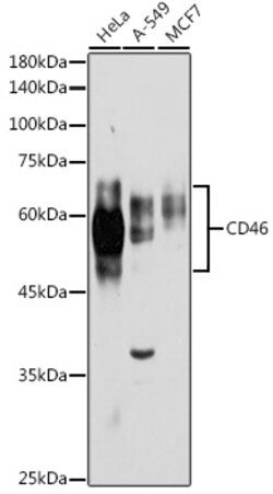 ABclonal Technology&nbsp;CD46 Rabbit pAb