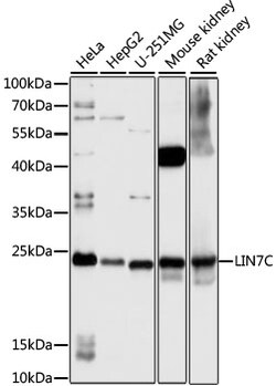 ABclonal Technology&nbsp;LIN7C Rabbit pAb