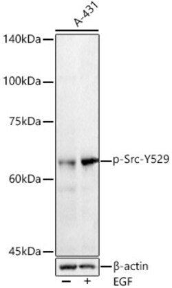 ABclonal Technology&nbsp;Phospho-Src-Y529 Rabbit pAb