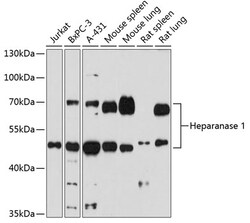 ABclonal Technology&nbsp;Heparanase 1 Rabbit pAb