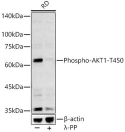 ABclonal Technology&nbsp;Phospho-AKT1-T450 Rabbit pAb