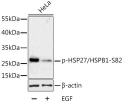 ABclonal Technology&nbsp;Phospho-HSP27/HSPB1-S82 Rabbit pAb