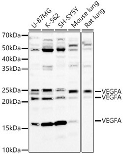 ABclonal Technology&nbsp;VEGFA Rabbit pAb