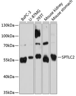 ABclonal Technology&nbsp;SPTLC2 Rabbit pAb