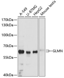 ABclonal Technology&nbsp;GLMN Rabbit pAb