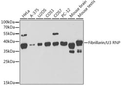 ABclonal Technology&nbsp;Fibrillarin/U3 RNP Rabbit pAb