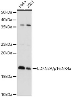ABclonal Technology&nbsp;CDKN2A/p16INK4a Rabbit pAb