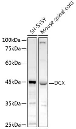 ABclonal Technology&nbsp;Doublecortin Rabbit pAb