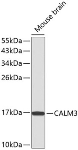 ABclonal Technology&nbsp;CALM3 Rabbit pAb
