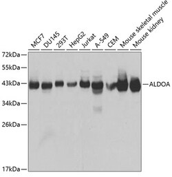 ABclonal Technology&nbsp;ALDOA Rabbit pAb