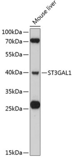 ABclonal Technology&nbsp;ST3GAL1 Rabbit pAb