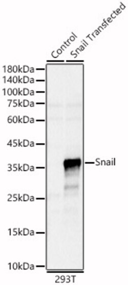 ABclonal Technology&nbsp;Snail Rabbit pAb
