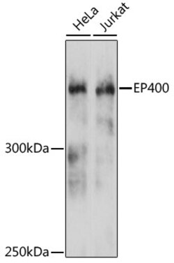 ABclonal Technology&nbsp;EP400 Rabbit pAb