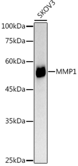 ABclonal Technology&nbsp;MMP1 Rabbit pAb